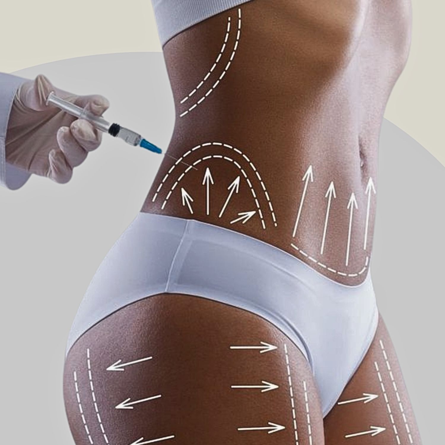 Kybella